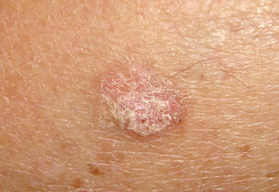 Clinic Study Photo