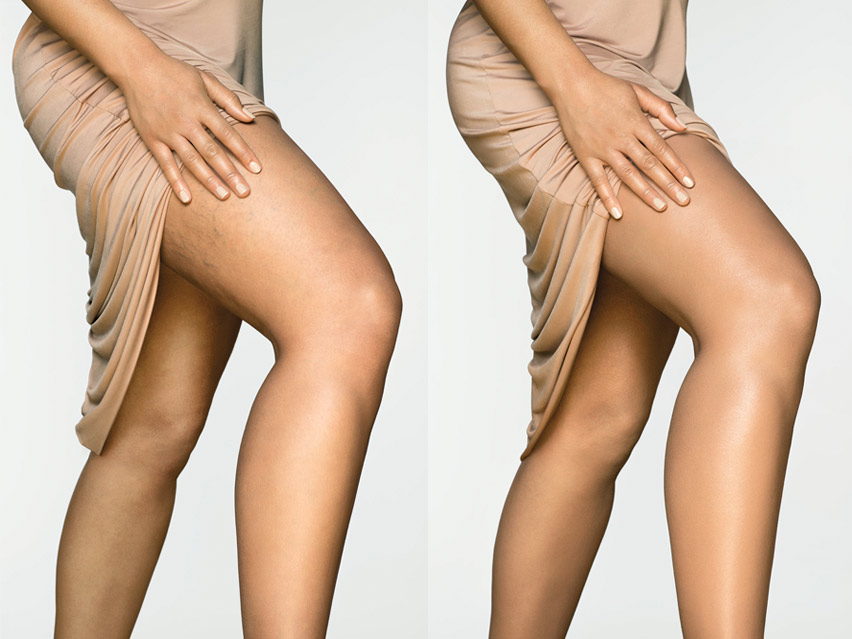 Dermablend Leg & Body Makeup LovelySkin